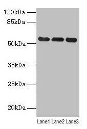 Vimentin Antibody - Western blot All lanes: VIM antibody at 8 µg/ml Lane 1: Hela whole cell lysate Lane 2: Jurkat whole cell lysate Lane 3: A549 whole cell lysate Secondary Goat polyclonal to rabbit IgG at 1/10000 dilution Predicted band size: 54 kDa Observed band size: 54 kDa