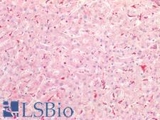 Vimentin Antibody - Human Liver: Formalin-Fixed, Paraffin-Embedded (FFPE)