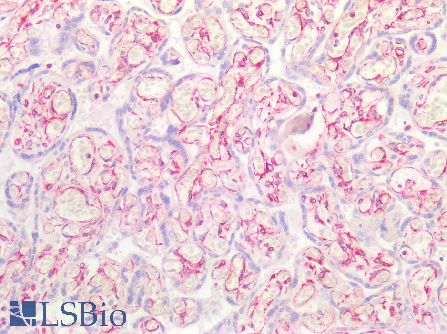 Vimentin Antibody - Human Placenta: Formalin-Fixed, Paraffin-Embedded (FFPE)