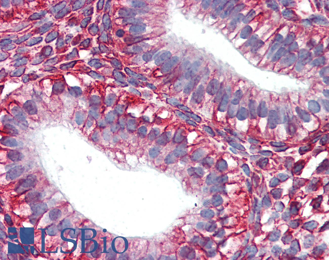 Vimentin Antibody - Anti-Vimentin antibody IHC of human uterus. Immunohistochemistry of formalin-fixed, paraffin-embedded tissue after heat-induced antigen retrieval. Antibody concentration 10 ug/ml. This image was taken for the unmodified form of this product. Other forms have not been tested.