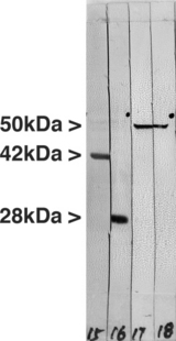 Vimentin Antibody - Western blot of crude extract of the human carcinoma HeLa cell line. Lane 18 was probed with Anti-Vimentin Antibody.