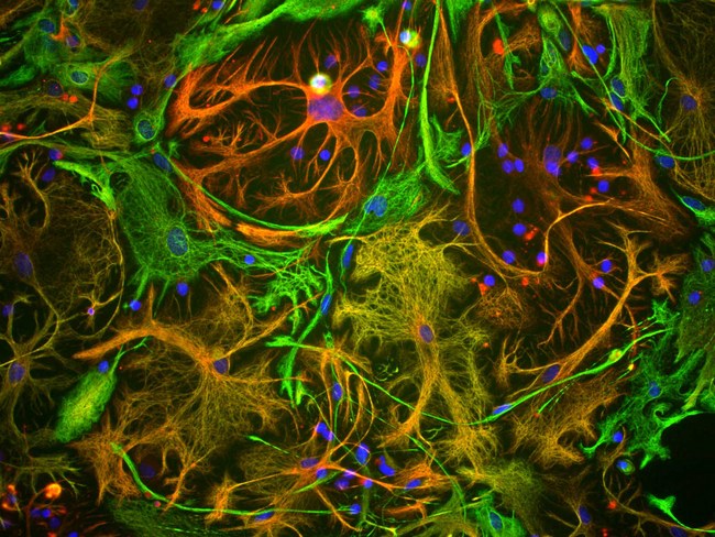 Vimentin Antibody - View of mixed neuron/glial cultures stained with vimentin antibody (green) and rabbit antibody to GFAP antibody (red). Vimentin is expressed alone in fibroblastic and endothelial cells, which are the flattened cells in the middle of the image which appear green. Astrocytes may express primarily GFAP, or GFAP and vimentin, and so appear red (GFAP only) or golden yellow (GFAP and Vimentin). In cells which express both GFAP and vimentin, the two protein assemble to produce heteropolymer filaments.