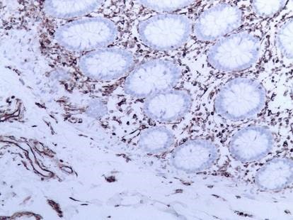 Vimentin Antibody - Strong specific staining of connective tissue cells with Vimentin in a frozen tissue section of human colon. No reactivity in epithelial cells.