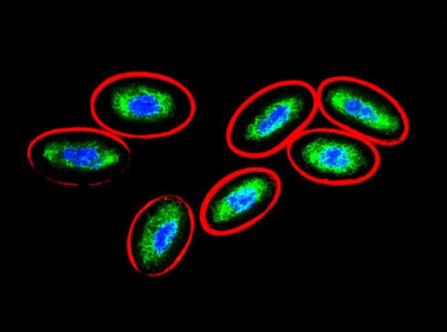 Vimentin Antibody - Immunofluorescence staining of chicken postnatal erythrocytes.  Tubulin (red) was stained with anti-alpha-tubulin (TU-01), vimentin (green) with anti-Vimentin (VI-10). Nuclei are stained with DAPI (blue).