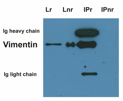 Vimentin Antibody - Immunoprecipitation of vimentin from HeLa cell lysate by antibody VI-10 and its detection by antibody VI-01. IgM heavy chain (76-92 kDa) and IgM light chain (25-30 kDa) indicated. Mr of vimentin is 57 kDa.  Lr = lysate (reducing conditions)  Lnr = lysate (non-reducing conditions)  IPr = immunoprecipitate (reducing conditions)  IPnr = immunoprecipitate (non-reducing conditions)