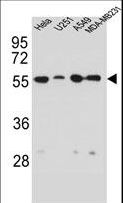 Vimentin Antibody - VIME Antibody western blot of HeLa,U251,A549,MDA-MB231 cell line lysates (35 ug/lane). The VIME antibody detected the VIME protein (arrow).