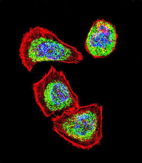 Vimentin Antibody - Confocal immunofluorescence of Vimentin Antibody with U251 cell followed by Alexa Fluor 488-conjugated goat anti-rabbit lgG (green). Actin filaments have been labeled with Alexa Fluor 555 phalloidin (red). DAPI was used to stain the cell nuclear (blue).