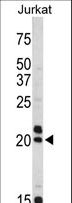VIP Antibody - Western blot of VIP antibody in Jurkat cell line lysates (35 ug/lane). VIP (arrow) was detected using the purified antibody.