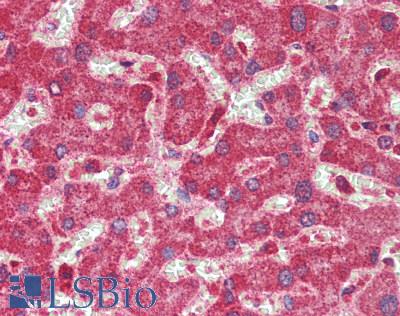VIPERIN / RSAD2 Antibody - Human Liver: Formalin-Fixed, Paraffin-Embedded (FFPE)