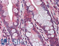 VIPERIN / RSAD2 Antibody - Human Small Intestine: Formalin-Fixed, Paraffin-Embedded (FFPE)