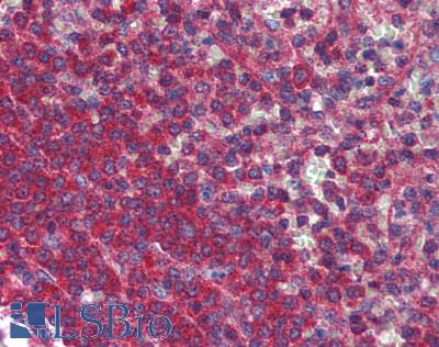 VIPERIN / RSAD2 Antibody - Human Spleen: Formalin-Fixed, Paraffin-Embedded (FFPE)
