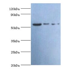 VISA / MAVS Antibody - Western blot. All lanes: MAVS antibody at 2 ug/ml. Lane 1: mouse heart tissue. Lane 2: Jurkat whole cell lysate. Lane 3: 293T whole cell lysate. Secondary antibody: Goat polyclonal to rabbit at 1:10000 dilution. Predicted band size: 57 kDa. Observed band size: 57 kDa.