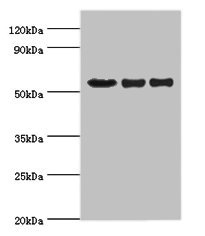 VISA / MAVS Antibody - Western blot All lanes: MAVS antibody at 2µg/ml Lane 1: Mouse heart tissue Lane 2: Jurkat whole cell lysate Lane 3: 293T whole cell lysate Secondary Goat polyclonal to rabbit IgG at 1/10000 dilution Predicted band size: 57, 16, 18, 41, 15 kDa Observed band size: 57 kDa