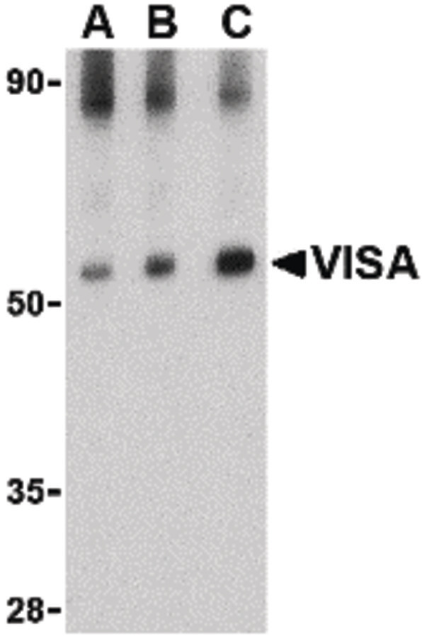 VISA / MAVS Antibody - Western blot of VISA in rat brain tissue lysate with VISA antibody at (A) 0.5, (B) 1 and (C) 2 ug/ml.