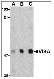 VISA / MAVS Antibody - Western blot of VISA in A20 cell lysate with VISA / MAVS Antibody at (A) 0.5, (B) 1 and (C) 2 ug/ml.