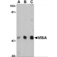 VISA / MAVS Antibody - Western blot analysis of VISA in A20 cell lysate with VISA antibody at (A) 0.5, (B) 1 and (C) 2 µg/mL.