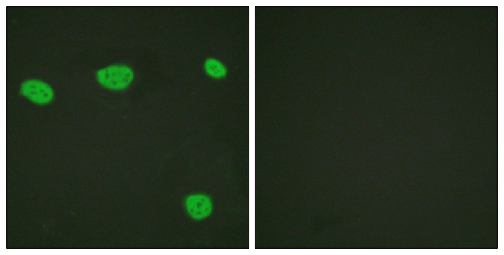 Vitamin D Receptor / VDR Antibody - Immunofluorescence analysis of HeLa cells, using Vitamin D Receptor Antibody. The picture on the right is blocked with the synthesized peptide.