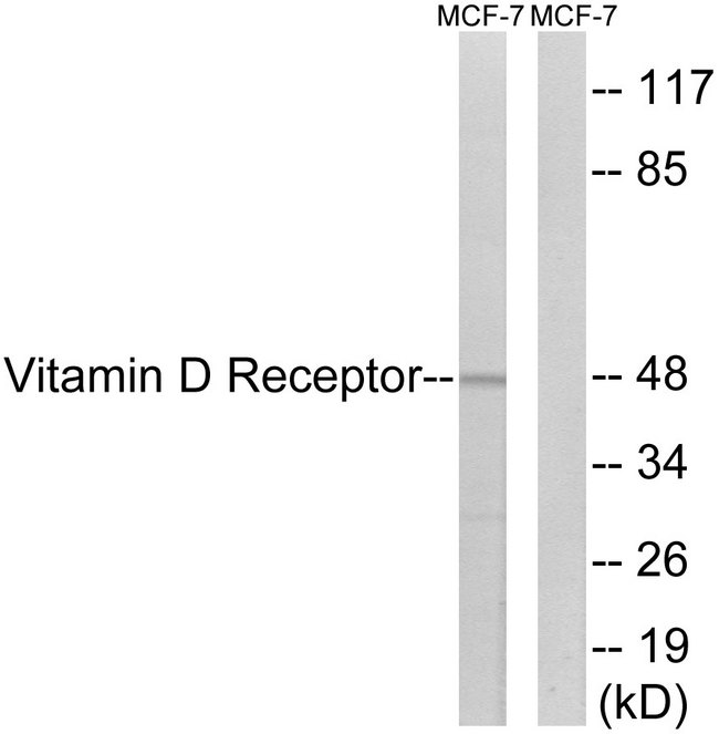 Vitamin D Receptor / VDR Antibody - Western blot analysis of Anti-VDR antibody (LS-B7259, 1:1000 dilution; 15 µg of lysate per lane). Lane 1: A431 cell line. Lane 2: MCF-7 cell line. Lane 3: MCF-7 cell line blocked with synthesized peptide. Antibody produced band at ~48 kDa (Isoform 1) but did not produce band when blocked.