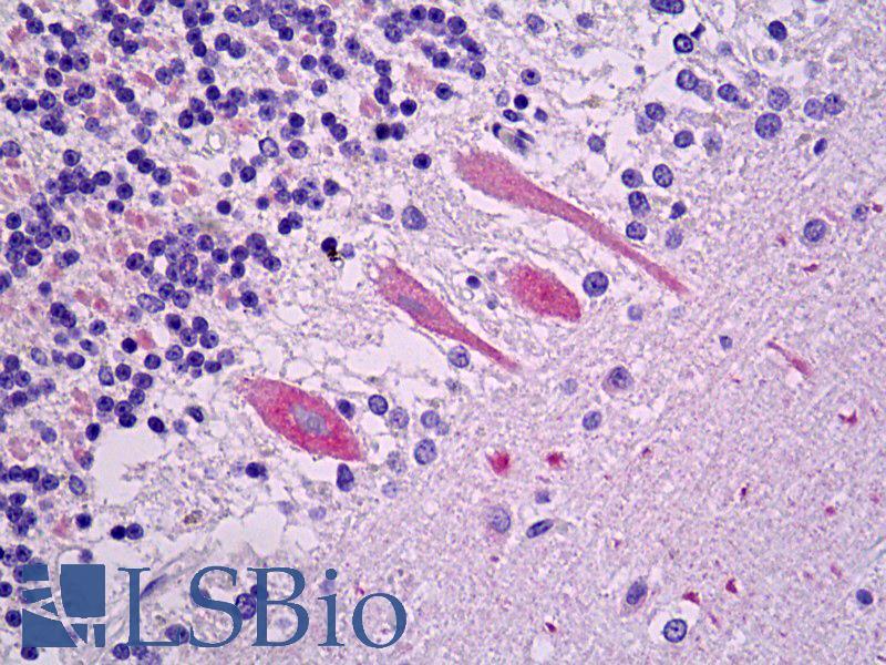 VLDLR Antibody - Anti-VLDLR antibody IHC of human brain, cerebellum, Purkinje. Immunohistochemistry of formalin-fixed, paraffin-embedded tissue after heat-induced antigen retrieval. Antibody dilution 1:50.