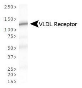VLDLR Antibody - Western Blot: VLDL Receptor Antibody (6A6) - Analysis of VLDL Receptor expression in mouse kidney.  This image was taken for the unconjugated form of this product. Other forms have not been tested.