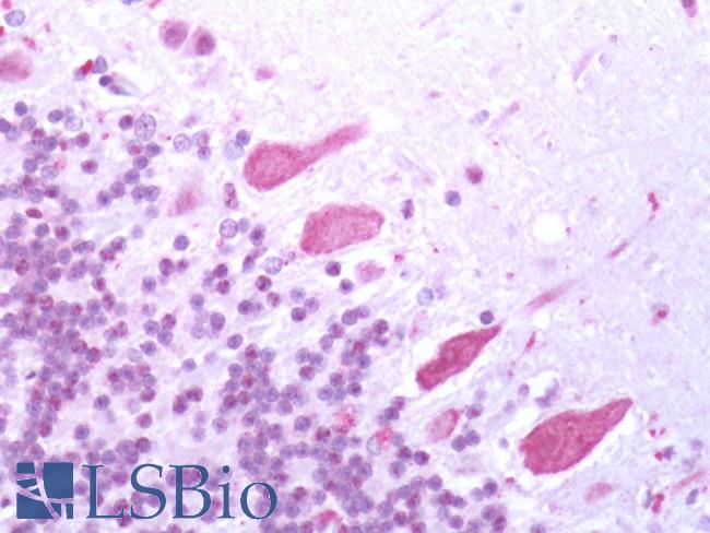 VMD2L3 / BEST3 Antibody - Human Brain, Cerebellum: Formalin-Fixed, Paraffin-Embedded (FFPE) 