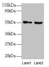 VOPP1 / ECOP Antibody - Western blot All lanes: Vesicular, overexpressed in cancer, prosurvival protein 1 antibody at 2µg/ml Lane 1: EC109whole cell lysate Lane 2: 293T whole cell lysate Secondary Goat polyclonal to rabbit IgG at 1/15000 dilution Predicted band size: 20, 19, 18 kDa Observed band size: 50 kDa