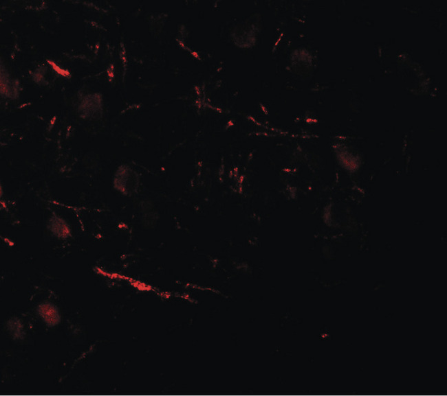 VPS13B Antibody - Immunofluorescence of COH1 in human brain tissue with COH1 antibody at 20 ug/ml.