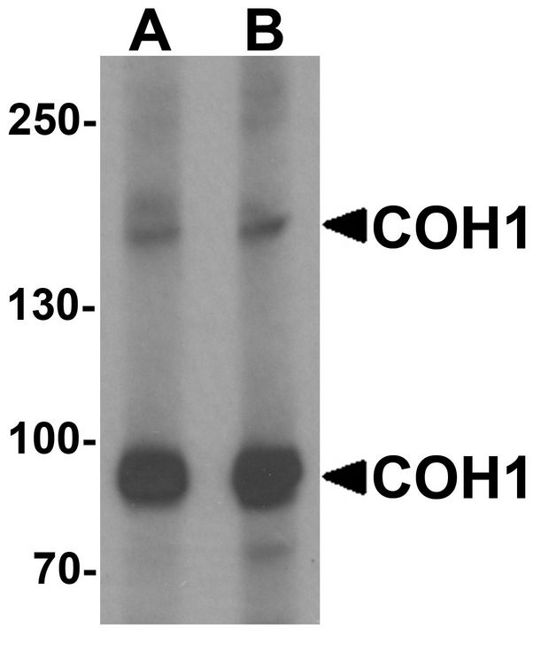VPS13B Antibody - Western blot analysis of COH1 in SK-N-SH cell lysate with COH1 antibody at (A) 1 and (B) 2 ug/ml.