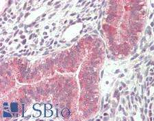 VPS16 Antibody - Human Uterus: Formalin-Fixed, Paraffin-Embedded (FFPE)