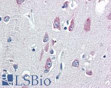 VPS25 Antibody - Anti-VPS25 antibody IHC of human brain, cortex. Immunohistochemistry of formalin-fixed, paraffin-embedded tissue after heat-induced antigen retrieval. Antibody concentration 5 ug/ml.