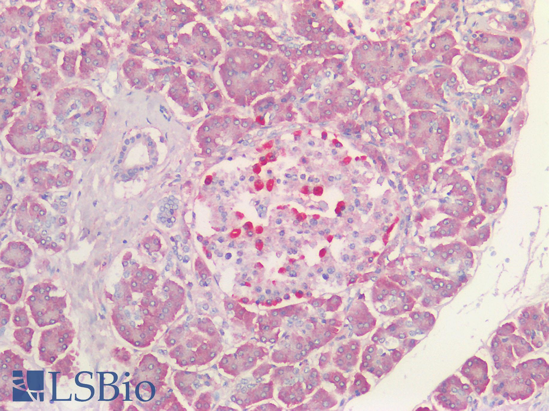 VPS35 Antibody - Human Pancreas: Formalin-Fixed, Paraffin-Embedded (FFPE) HIER using 10 mM sodium citrate buffer pH 6.0