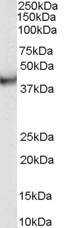 VPS37C Antibody - Antibody (0.03g/ml) staining of human duodenum lysate (35 ug protein in RIPA buffer). Primary incubation was 1 hour. Detected by chemiluminescence.