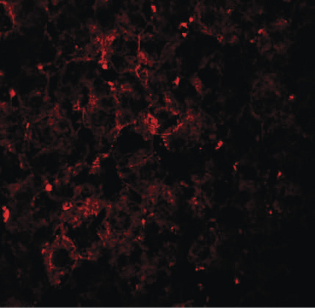 VPS39 Antibody - Immunofluorescence of VPS39 in mouse liver tissue with VPS39 antibody at 20 ug/ml.