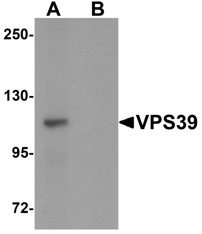 VPS39 Antibody - Western blot analysis of VPS39 in rat liver tissue lysate with VPS39 antibody at 0.5 ug/ml in (A) the absence and (B) the presence of blocking peptide.