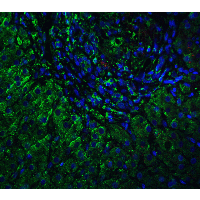 VPS39 Antibody - Immunofluorescence of VPS39 in human liver tissue with VPS39 antibody at 5 µg/ml. Green: VPS39 antibody  Red: Phylloidin staining Blue: DAPI staining