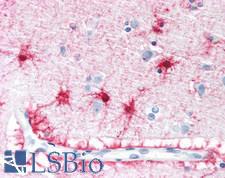 VPS45 Antibody - Human Brain, Cortex: Formalin-Fixed, Paraffin-Embedded (FFPE)