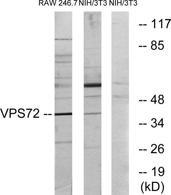 VPS72 Antibody - Western blot analysis of lysates from RAW264.7 and NIH/3T3 cells, using VPS72 Antibody. The lane on the right is blocked with the synthesized peptide.