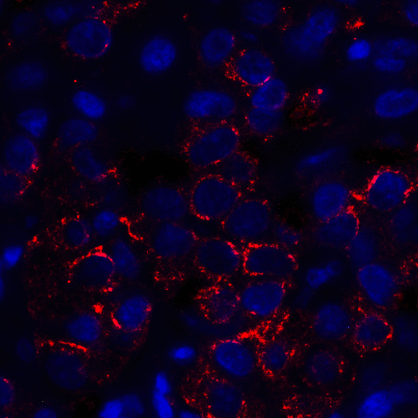 VSIR / GI24 / VISTA Antibody - Immunofluorescence of VISTA in human lymphoma tissue with VISTA antibody at 5 ug/mL. Red: VISTA Antibody [4C4] Blue: DAPI staining