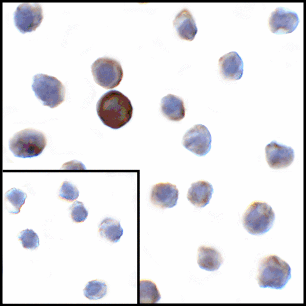 VSIR / GI24 / VISTA Antibody - Immunocytochemistry of VISTA in transfected HEK293 cells with VISTA antibody at 1 ug/mL. Lower left: Immunocytochemistry in transfected HEK293 cells with control mouse IgG antibody at 1 ug/mL.