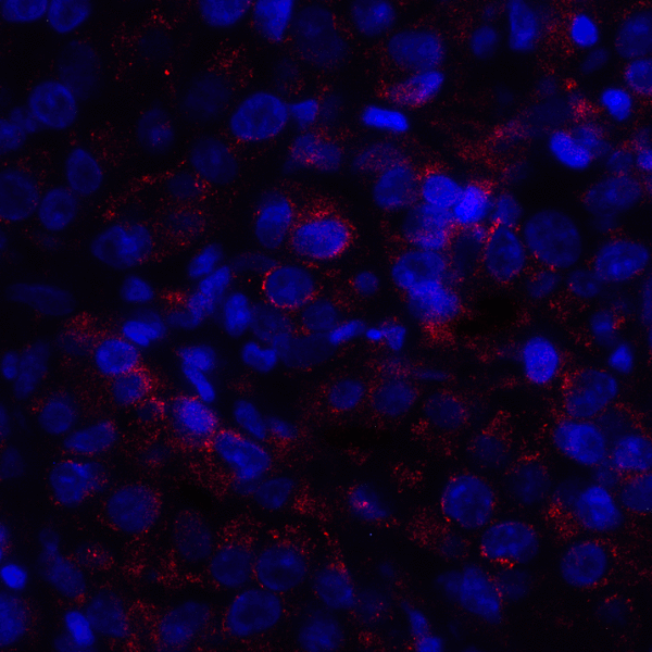 VSIR / GI24 / VISTA Antibody - Immunofluorescence of VISTA in human lymphoma tissue with VISTA antibody at 10 ug/mL. Red: VISTA Antibody [8E11] Blue: DAPI staining