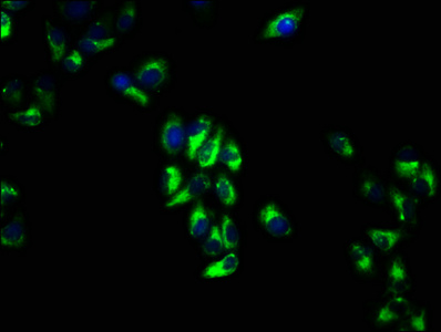 VTCN1 / B7-H4 Antibody - Immunofluorescence staining of Hela cells with VTCN1 Antibody at 1:66, counter-stained with DAPI. The cells were fixed in 4% formaldehyde, permeabilized using 0.2% Triton X-100 and blocked in 10% normal Goat Serum. The cells were then incubated with the antibody overnight at 4°C. The secondary antibody was Alexa Fluor 488-congugated AffiniPure Goat Anti-Rabbit IgG(H+L).
