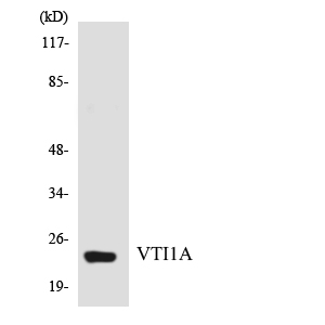 VTI1A Antibody - Western blot analysis of the lysates from HUVECcells using VTI1A antibody.