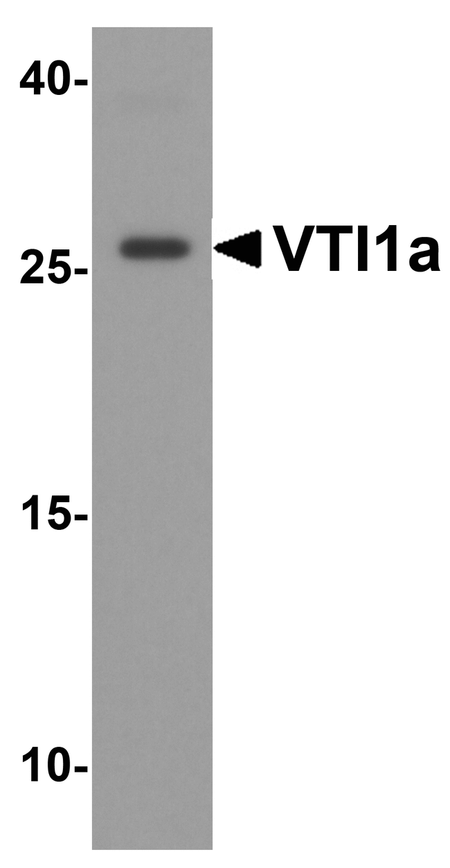 VTI1A Antibody - Western blot analysis of VTI1a in human brain tissue lysate with VTI1a antibody at 1 ug/ml.
