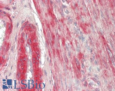 VTI1B Antibody - Human Uterus, Myometrium: Formalin-Fixed, Paraffin-Embedded (FFPE)
