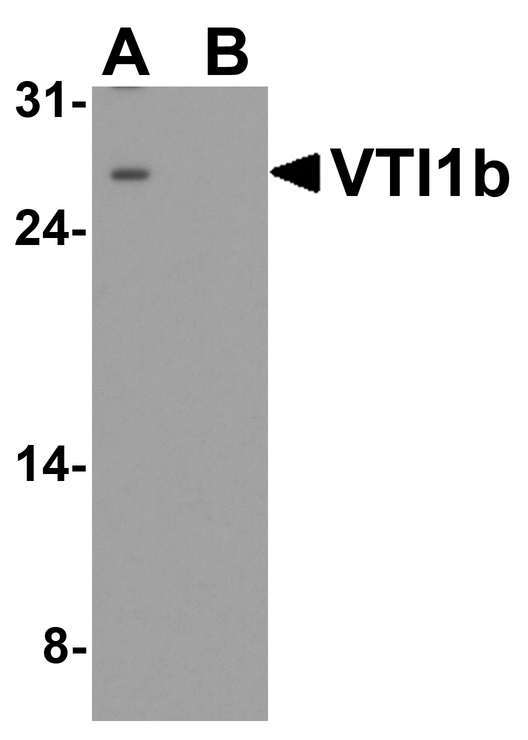VTI1B Antibody - Western blot analysis of VTI1b in HeLa cell lysate with VTI1b antibody at 1 ug/ml in (A) the absence and (B) the presence of blocking peptide.