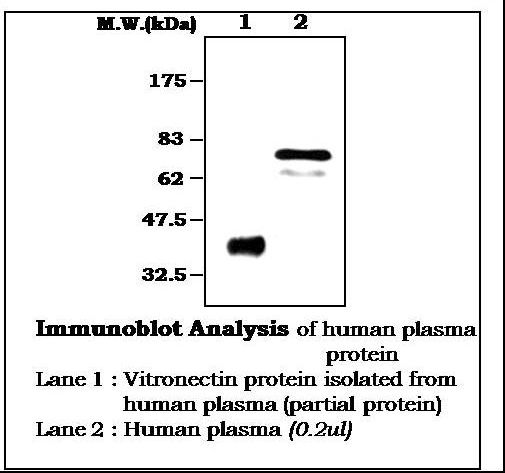 VTN / Vitronectin Antibody
