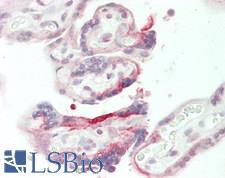 VWA9 / C15orf44 Antibody - Human Placenta: Formalin-Fixed, Paraffin-Embedded (FFPE)