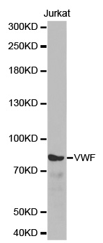 VWF / Von Willebrand Factor Antibody - Western blot analysis of extracts of Jurkat cells.