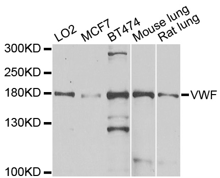VWF / Von Willebrand Factor Antibody - Western blot analysis of extracts of various cell lines, using VWF antibody at 1:1000 dilution. The secondary antibody used was an HRP Goat Anti-Rabbit IgG (H+L) at 1:10000 dilution. Lysates were loaded 25ug per lane and 3% nonfat dry milk in TBST was used for blocking. An ECL Kit was used for detection and the exposure time was 15s.