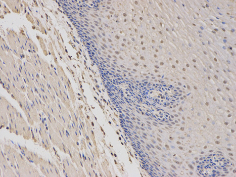 WAS / WASP Antibody - Immunohistochemistry of paraffin-embedded human esophagus using WAS antibody at dilution of 1:100 (200x lens).